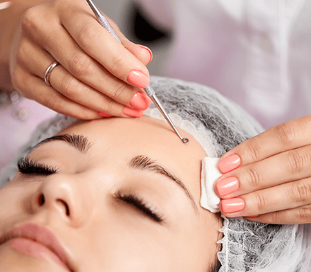 Revitalizing Microneedling Treatment at our Boca Raton Spa