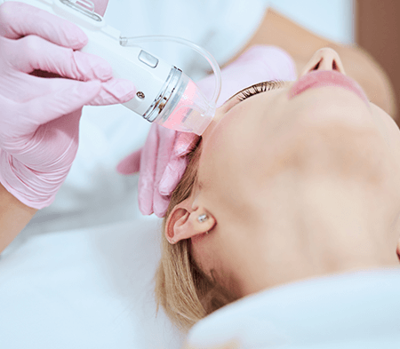 Discover the Magic of Microneedling at Boca Raton’s Premier Spa